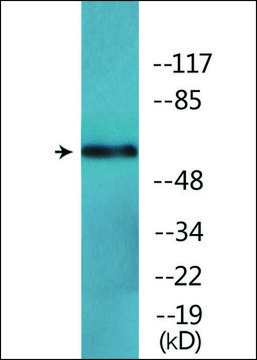 Anti-phospho-RelB (pSer??²) antibody produced in