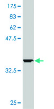ANTI-HD antibody produced in mouse