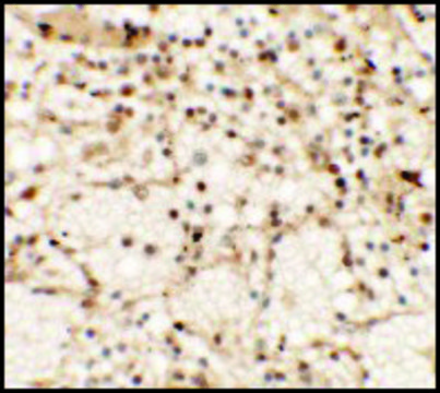 Anti-CLEC7A antibody produced in rabbit