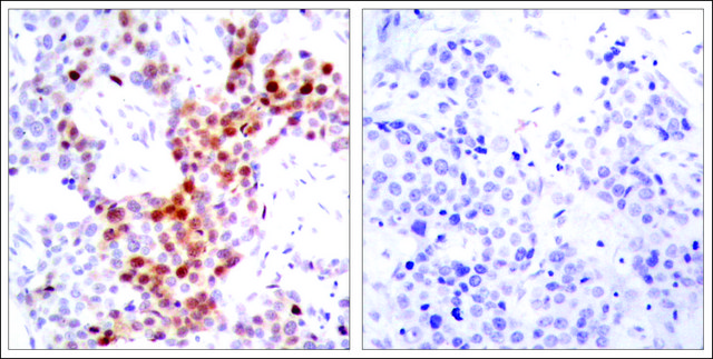 Anti-phospho-ATF2 (pThr?? or pThr?¹) antibody