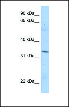 Anti-MRPL15, (N-terminal) antibody produced in