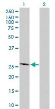 Anti-PROP1 antibody produced in rabbit