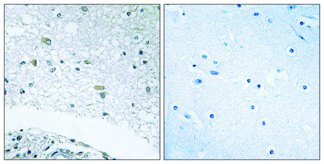 Anti-LAMC3 antibody produced in rabbit