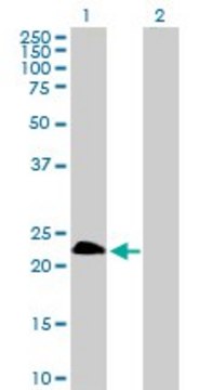 Anti-TWIST1 antibody produced in rabbit