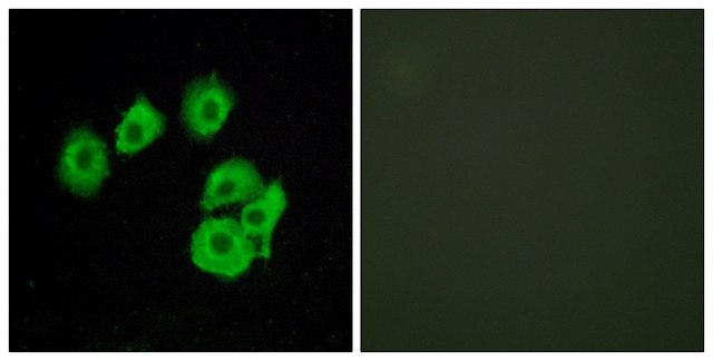 Anti-CLTR1 antibody produced in rabbit