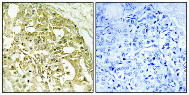 Anti-Catenin-? antibody produced in rabbit