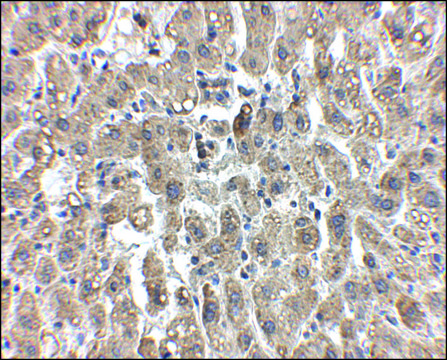 Anti-LDL-R antibody produced in chicken