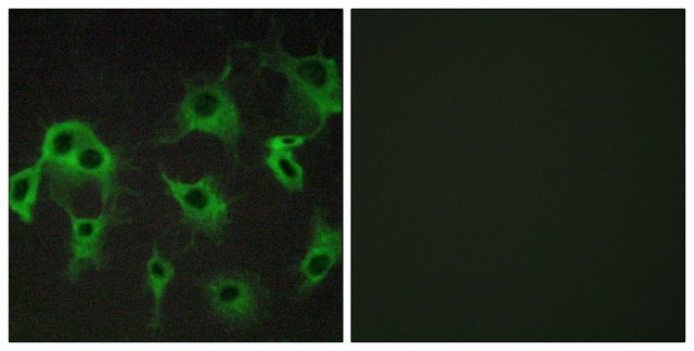 Anti-ADRB2 antibody produced in rabbit