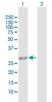 Anti-AK2 antibody produced in rabbit