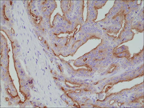 Anti-PSMA antibody, Rabbit monoclonal