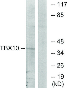 Anti-TBX10 antibody produced in rabbit