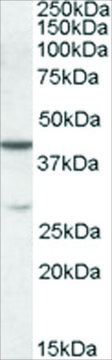 Anti-CBX8 antibody produced in goat