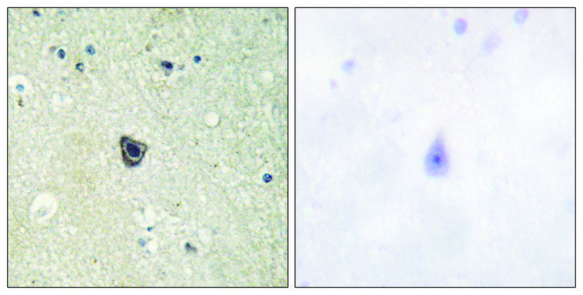 Anti-CSFR antibody produced in rabbit