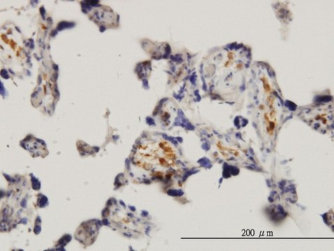 ANTI-MKNK1 antibody produced in mouse
