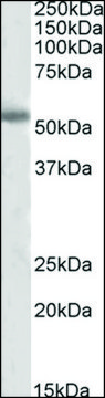 Anti-TH (C-terminal) antibody produced in