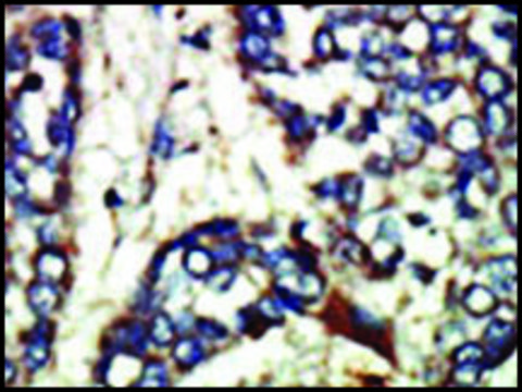 Anti-NEK1 (C-term) antibody produced in