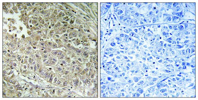 Anti-ABCC13 antibody produced in rabbit