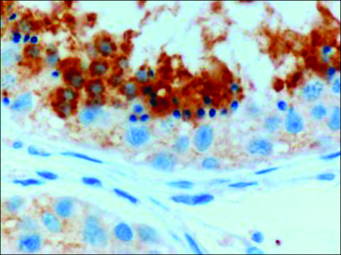 Anti-GPX4 (Isoform A and C)