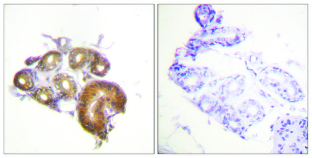 Anti-ETK antibody produced in rabbit