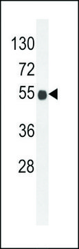 ANTI-B3GNT6 (CENTER) antibody produced in