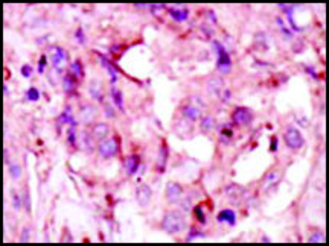 Anti-GCKR (C-term) antibody produced in