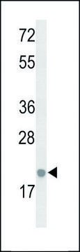 ANTI-IL26 (CENTER) antibody produced in