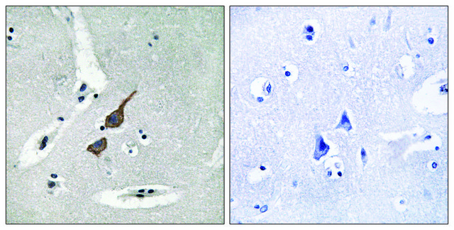Anti-GRID1 antibody produced in rabbit