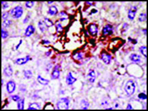 Anti-USP11 (N-term N20) antibody produced