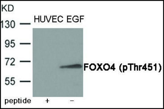 Anti-phospho-FOXO4 (pThr??¹) antibody produced in