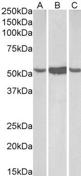 Anti-ALDH1A1, C-Terminal antibody produced in