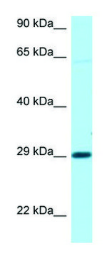 Anti-NIPA1 (C-terminal) antibody produced in