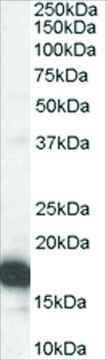 Anti-CDKN2A (Isoform 1)/P16INK4A antibody produced