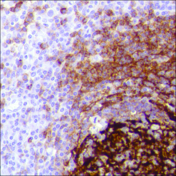 Anti-CD21 antibody, Rabbit monoclonal