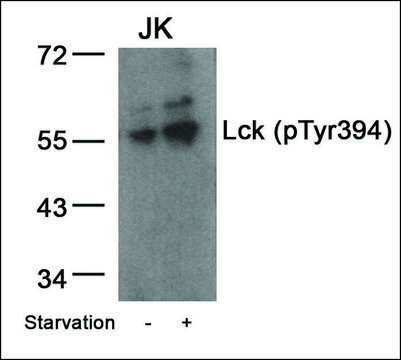 Anti-phospho-LCK (pTyr³??) antibody produced in