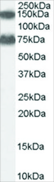 Anti-ACOX2 (AB1) antibody produced in