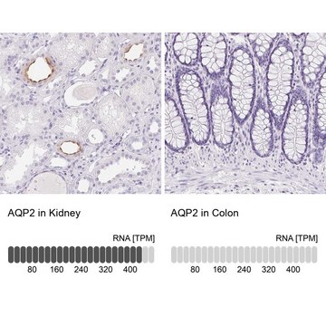 Anti-AQP2 antibody produced in rabbit