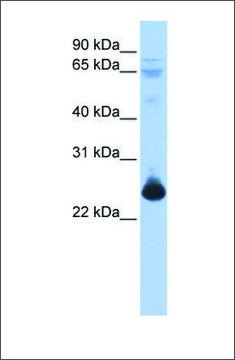 Anti-TCEAL1 antibody produced in rabbit
