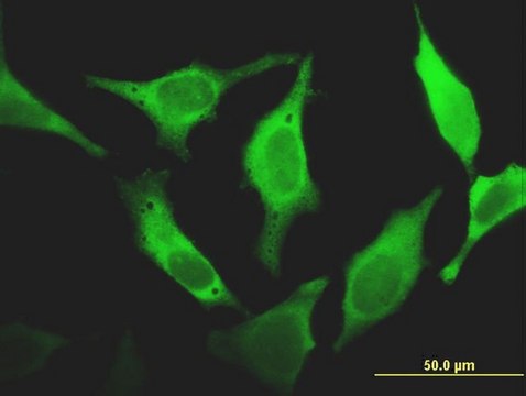 ANTI-FHIT antibody produced in mouse