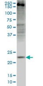 Monoclonal Anti-CRYGD antibody produced in