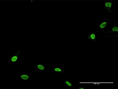 Anti-TNNI3K antibody produced in rabbit