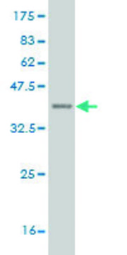 ANTI-DLX1 antibody produced in mouse