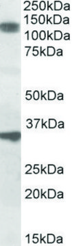 Anti-CCAR1 antibody produced in goat