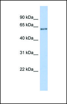 Anti-PCCB antibody produced in rabbit