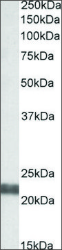 Anti-UBE2F (N-terminal) antibody produced in
