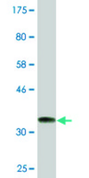 Monoclonal Anti-ARMC4, (C-terminal) antibody produced