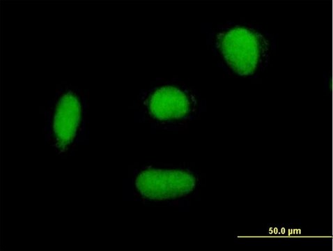 Anti-ELAC2 antibody produced in mouse