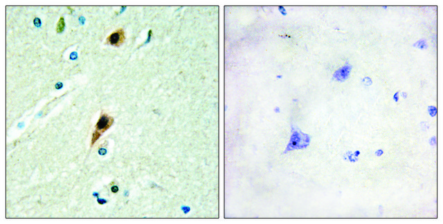 Anti-RBM5 antibody produced in rabbit
