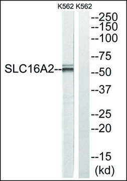 Anti-SLC16A2 antibody produced in rabbit