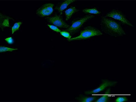 Anti-PANK4 antibody produced in rabbit
