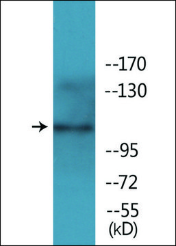 Anti-phospho-EPHA2/3 (pTyr588/596) antibody produced in